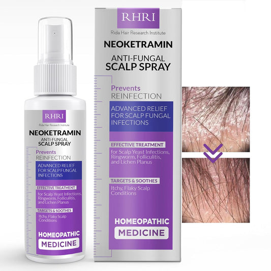 Anti Fungal Scalp Spray for Flaky, Itchy Scalp Relief | Antifungal Spray for Scalp Yeast Infections, Ringworm & Folliculitis | Cleanses & Improves Hair Health | Dry Itchy Scalp Treatment
